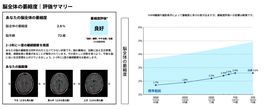脳全体の萎縮度 評価サマリー あなたの脳全体の萎縮度 2.6% 脳年齢72歳 萎縮度評価：良好 2〜3年に一度の継続観察を推奨