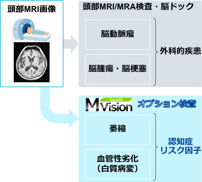 頭部MRI画像から、脳ドック（外科的疾患：脳動脈瘤、脳腫瘍・脳梗塞）とMVision healthオプション検査（認知症リスク因子：萎縮、血管性劣化・白質病変）へ分岐するフロー図