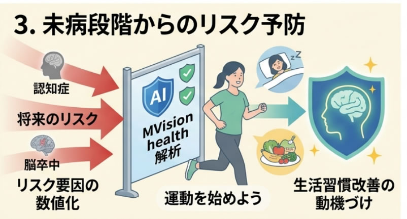 未病段階からのリスク予防 認知症 将来のリスク 脳卒中 リスク要因の数値化 MVision health解析 運動を始めよう 生活習慣改善の動機づけ