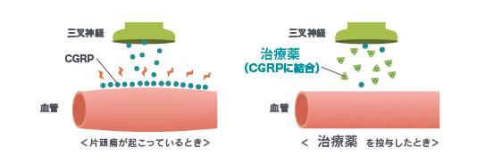 当院で使用できる治療薬